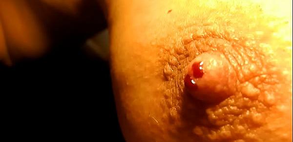  little needles pulling out from nipple